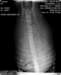 cyoupupxray_small.jpg
